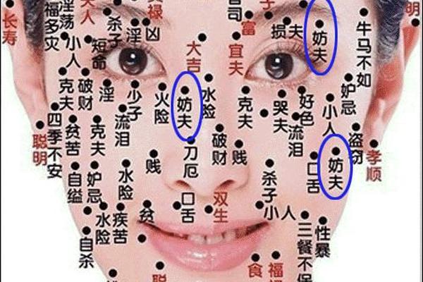 痣相防夫 妨夫痣点掉就化解了吗